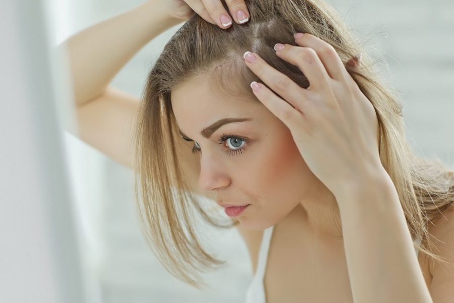 Causas da queda de cabelo feminino